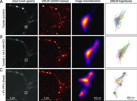 Single molecule localisation microscopy SMLM of α synuclein in