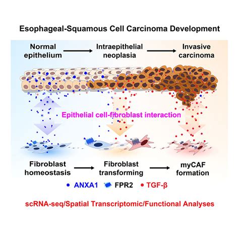 Epithelial Cells Activate Fibroblasts To Promote Esophageal Cancer