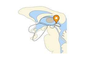 Habenula - e-Anatomy - IMAIOS