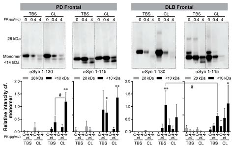 Biomolecules Free Full Text Rt Quic Using C Terminally Truncated α