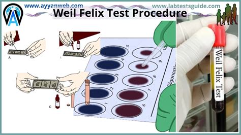 Test Procedures Lab Tests Guide