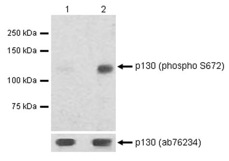 Anti P130 Phospho S672 Antibody EP2126Y Ab76255 Abcam