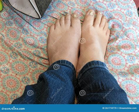 Naked Bare Ugly Toes White Stock Photo Image Of Toes 261718770