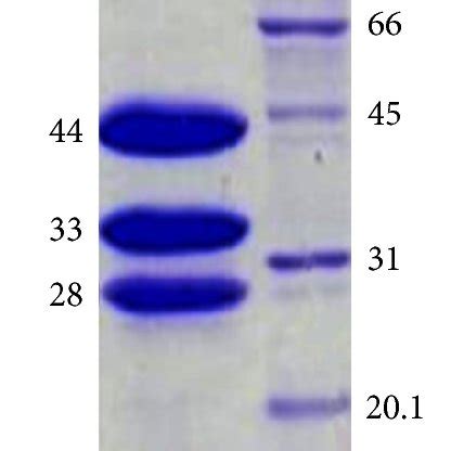 Sds Page Analysis Of Purified Enzymes A G Of The Purified