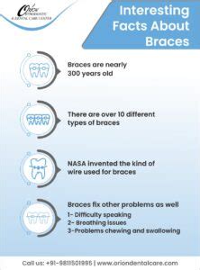 How Long Do Braces Take Duration More Orion Dental Care