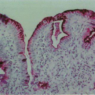 Section Of A Duodenal Biopsy Specimen Stained With Diastase PAS Alcian