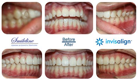 Beautiful Smiles Of SmileLine Dental