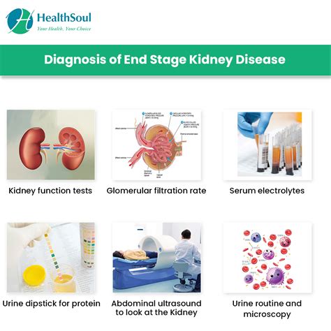 End Stage Kidney Disease Causes And Management Healthsoul