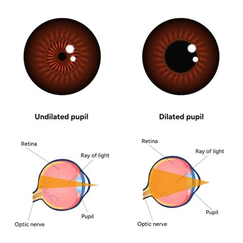 Premium Vector Pupil Size In Different Lighting Dilated Pupil And