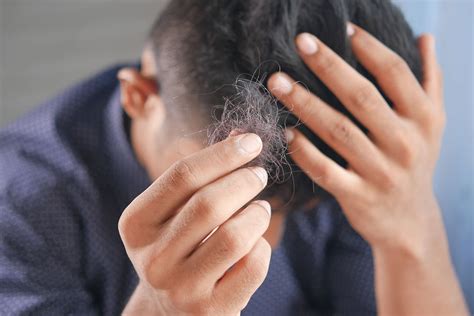 Types Of Hair Loss How To Treat Them