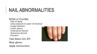 Nail Abnormalities | PPT