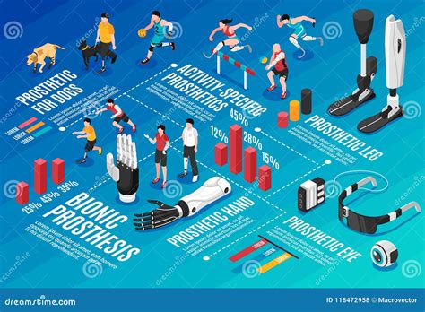 Bionic Prothesis Isometric Infographics Stock Vector Illustration Of