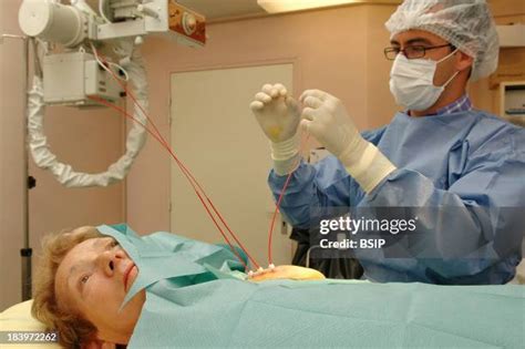 Brachy Therapy Photos and Premium High Res Pictures - Getty Images