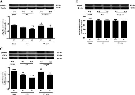 Change In Cardiac Apn Receptor Adipor Expression After Sn Cardiac