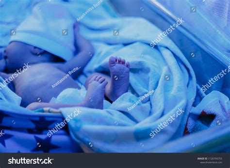 Baby Newborn Elevated Bilirubin Lies Under Foto de stock 1126704755