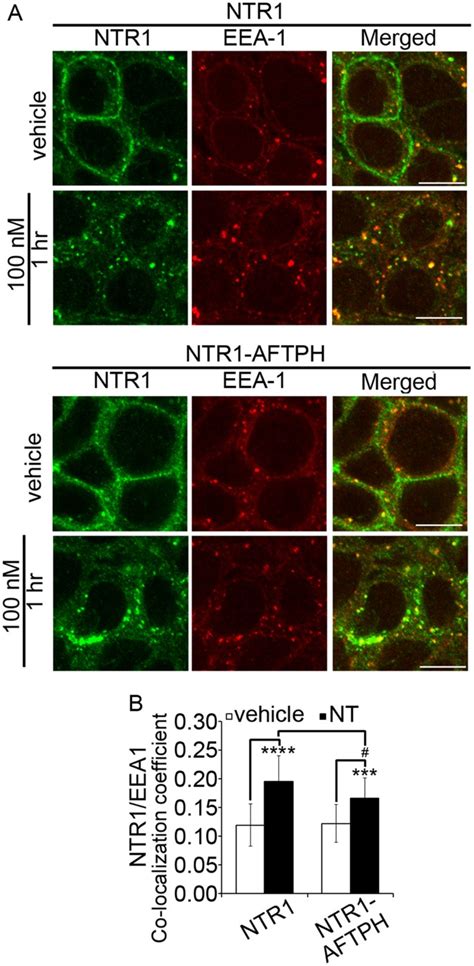 Neurotensin Induced Mir 133α Expression Regulates Neurotensin Receptor