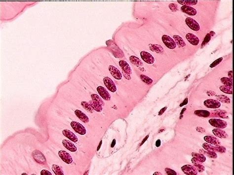 Simple Columnar Epithelium Histology Lab Photo Quiz Flashcards