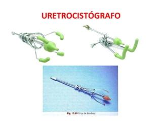 Radiologianota Uretrocistografia Retr Grada E Miccional Ppt