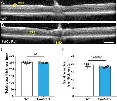 Frontiers Tyro3 Contributes To Retinal Ganglion Cell Function