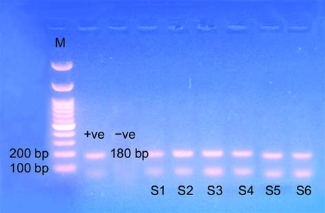 Ethidium Bromide Stained Agarose Gel Showing Pcr Amplified Product