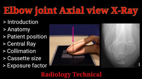 Elbow Joint Axial View X Ray Patient Position For X Ray By BL