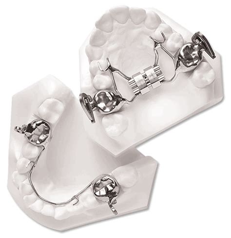 Fixed Orthodontic Appliances Dynaflex