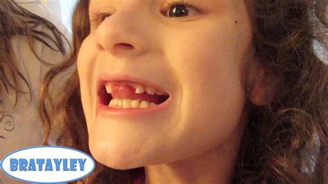 The Toothless Wonder Wk Bratayley Youtube