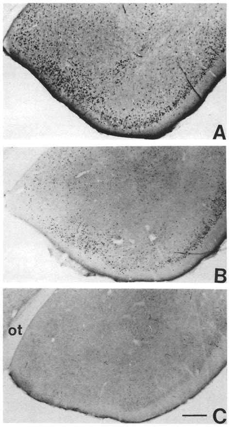 Photomicrographs Showing Fos Ir Neurons In The Piriform Cortex Of Male