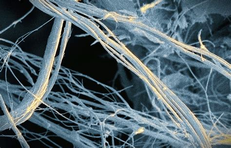 The Silent Killer in Schools: Government Under Fire for Failing to Act