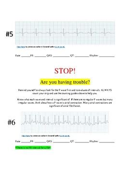 Ekg Strip Counting Practice By The Nursing Spot Tpt