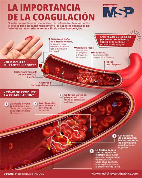 La importancia de la coagulación Infografía