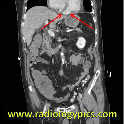 Gi Radiologypics Com