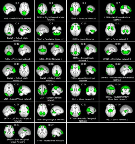 Resting State Networks Rsns Inferred From The Hc Group Using Group