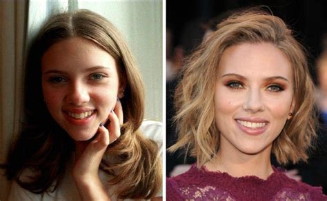 Antes Y Despu S De La Rinoplastia En Famosos Scarlet Johanson