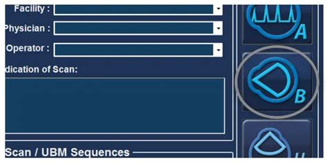 REV B Accutome Connect Ultrasound System User Guide