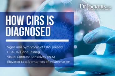 CIRS: Causes, Symptoms and Solutions - DrJockers.com