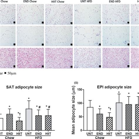 H E Staining Of Fat Tissues And Adipocyte Size In SAT And EPI 3A H E