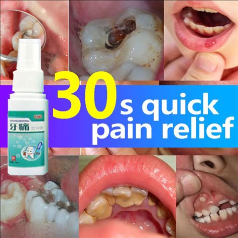 Gamot Sa Masakit Na Ngipin Toothache Pain Relief 35ml Bad Breath