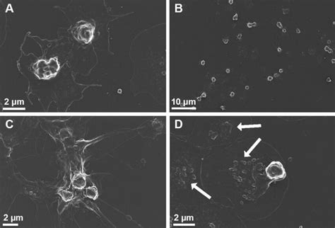 Scanning Electron Micrographs Of Platelets From Diabetic Volunteers