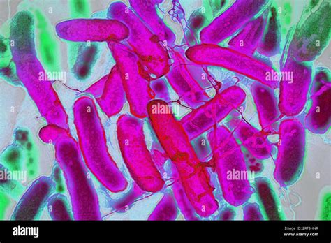 Escherichia Coli Bakterien Im Blut Fotos Und Bildmaterial In Hoher Auflösung Alamy