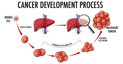 Kidney Cancer What I Should Know As A Patient Meds For Cancer