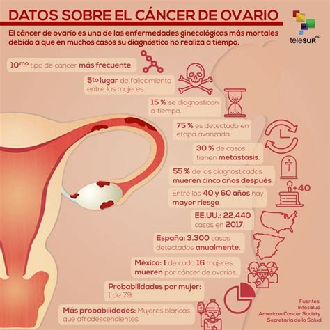 D A Mundial Del C Ncer De Ovario De Cada Mujeres De A Os