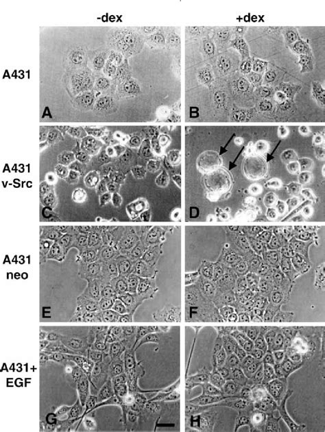 Figure 6 From Src Induces Morphological Changes In A431 Cells That