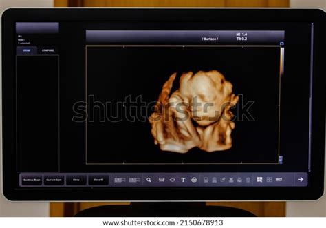 Inside The Womb 3d: Over 26 Royalty-Free Licensable Stock Photos ...