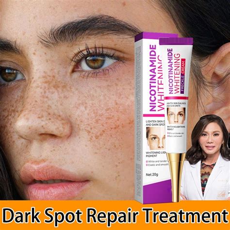 Whitening Anti Freckle Cream Nicotinamide Remove Dark Spot Melasma