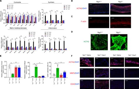 Neutrophil Extracellular Traps Induce Abdominal Aortic Aneurysm