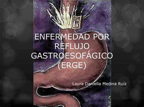 Enfermedad Por Reflujo Gastroesofagico Erge Ppt