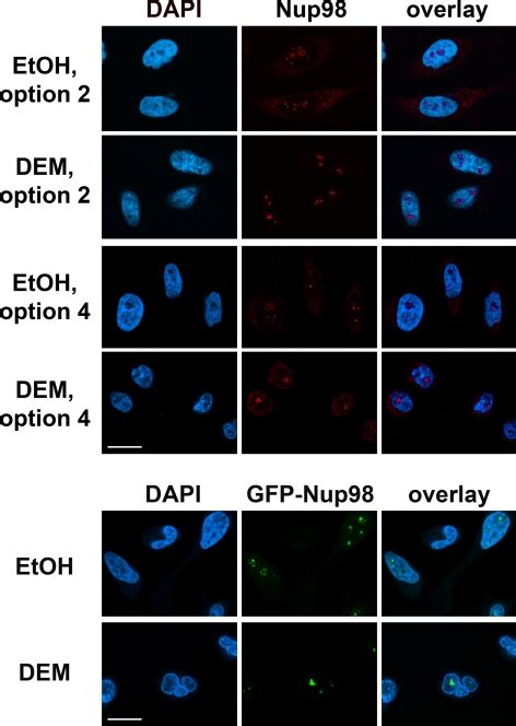 Oxidative Stress Inhibits Nuclear Protein Export By Multiple Mechanisms