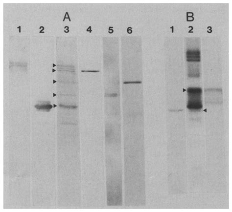 Immunological Identification Ofthylakoid Proteins From Day Old