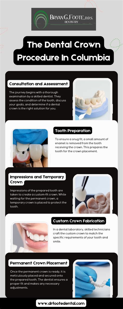 The Dental Crown Procedure In Columbia - Dr. Foote Dental - Medium